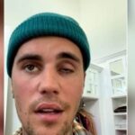 Qué es el síndrome de Ramsay Hunt, enfermedad que afectó la cara de Justin Bieber