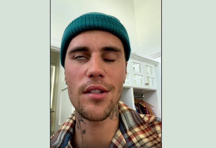 Justin Bieber tiene parálisis facial a causa del síndrome de Ramsay Hunt