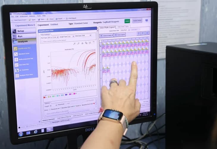 Brasil roza los 1.000 casos de la viruela del mono