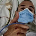 Valverde y otros 2 ciclistas, leves tras ser atropellados por coche a la fuga 2