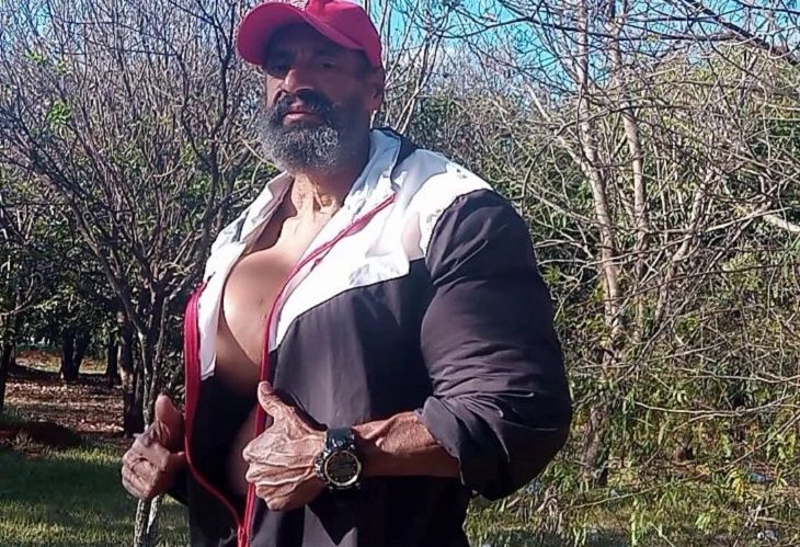 Murió Valdir Segato, el Hulk brasileño que se inyectó aceite natural en los músculos