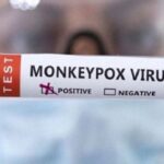 En Colombia hay 273 casos de viruela del mono confirmados