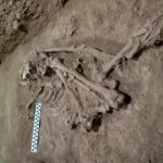 La primera amputación quirúrgica se habría realizado hace 31.000 años