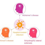 Sufrir infecciones hospitalarias eleva el riesgo de Alzheimer y Parkinson
