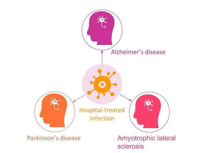 Sufrir infecciones hospitalarias eleva el riesgo de Alzheimer y Parkinson