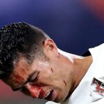 Cristiano termina con la nariz ensangrentada tras choque con un portero