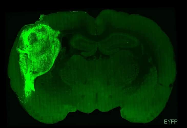 Implantan “minicerebros” derivados de células humanas a ratas recién nacidas