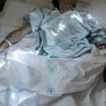La OMS lanza un primer sondeo global sobre las necesidades de los enfermos de cáncer
