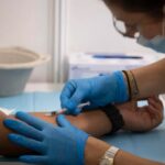 México confirma 1.968 casos de viruela símica y el 98 % son hombres