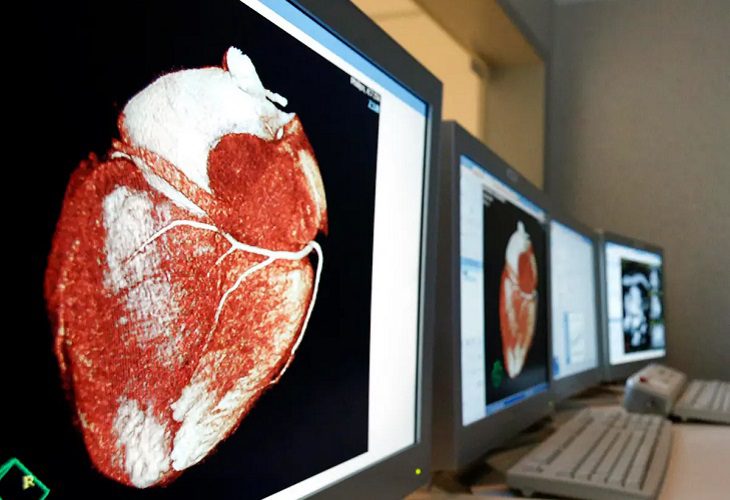Salud promueve la reanimación cardíaca - “Si no haces nada, es un muerto”