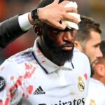 El gol con el que Rüdiger salvó al Madrid le costó 20 puntos de sutura