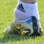 ¿Qué es el bulto en tobillo de Lionel Messi?
