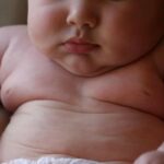 EE.UU. amplía la herramienta para medir la obesidad infantil
