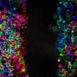 Científicas prueban terapia ultrasónica para combatir el cáncer de páncreas