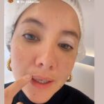 Daniella Álvarez revela que tiene vitíligo en uno de sus ojos