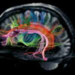 China crea microscopio de tres fotones para imágenes de cerebro profundo
