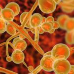 Candida auris: el peligroso hongo que se multiplica en hospitales de EE.UU.