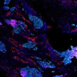 El mapa más amplio del cáncer de pulmón pone el foco en la diversidad tumoral