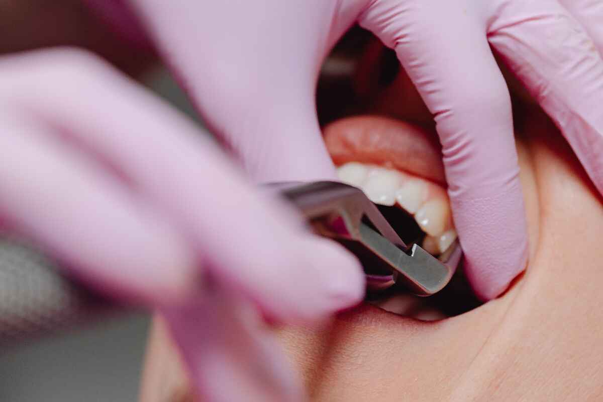 Dentista revela los 4 errores comunes que dañan los dientes
