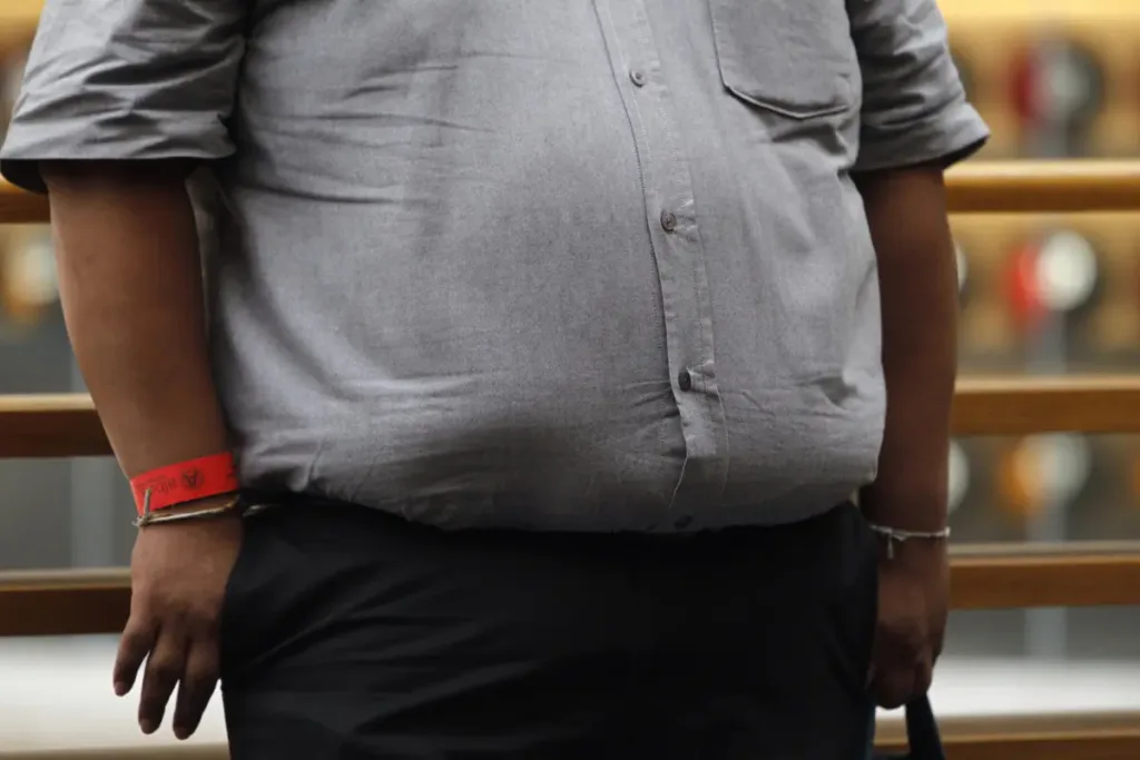 La obesidad, un factor de riesgo para el cáncer que varía según el sexo y el tipo de tumor