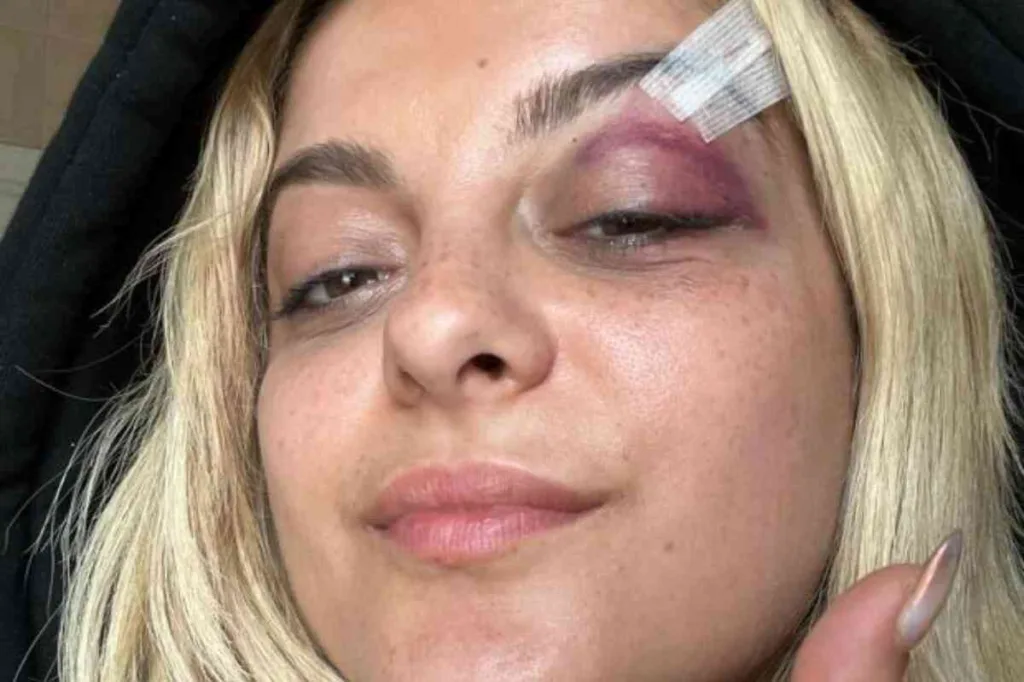 Un fan le lanza un celular a Bebe Rexha y la deja herida en plena actuación