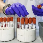 OMS - La hepatitis podría ser más letal que la malaria, la tuberculosis y el sida en 2040
