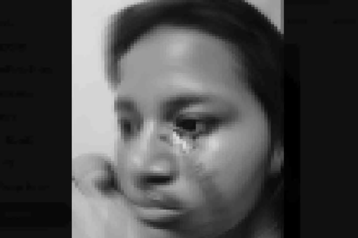 La joven colombiana que llora lágrimas de sangre por una extraña condición