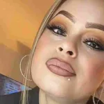 mexicana pierde sus cuatro extremidades por una bacteria que comió con tilapia-Laura Barajas