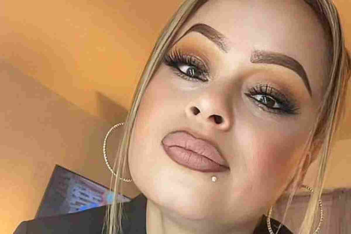 mexicana pierde sus cuatro extremidades por una bacteria que comió con tilapia-Laura Barajas