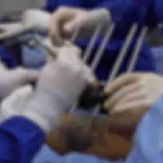 Yeferson Cossio se sometió a una cirugía para alargar sus piernas: ¿cuánto le costó y cómo le quedaron?