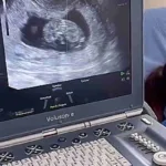 Epa Colombia está embarazada: así fue el proceso de inseminación con su novia
