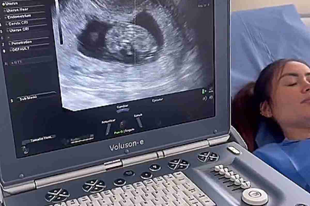 Epa Colombia está embarazada: así fue el proceso de inseminación con su novia