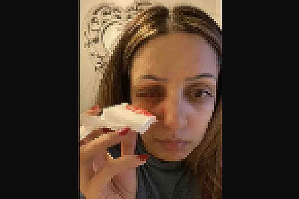 Mujer sufrió una infección ocular por una ameba que se alojó en su ojo