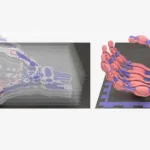 Crean una mano robótica blanda con huesos, ligamentos y tendones mediante impresión 3D