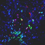 Los nanoplásticos favorecen condiciones del párkinson en varios modelos de laboratorio