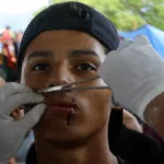Migrantes se cosen la boca para pedir documentos de tránsito en sur de México