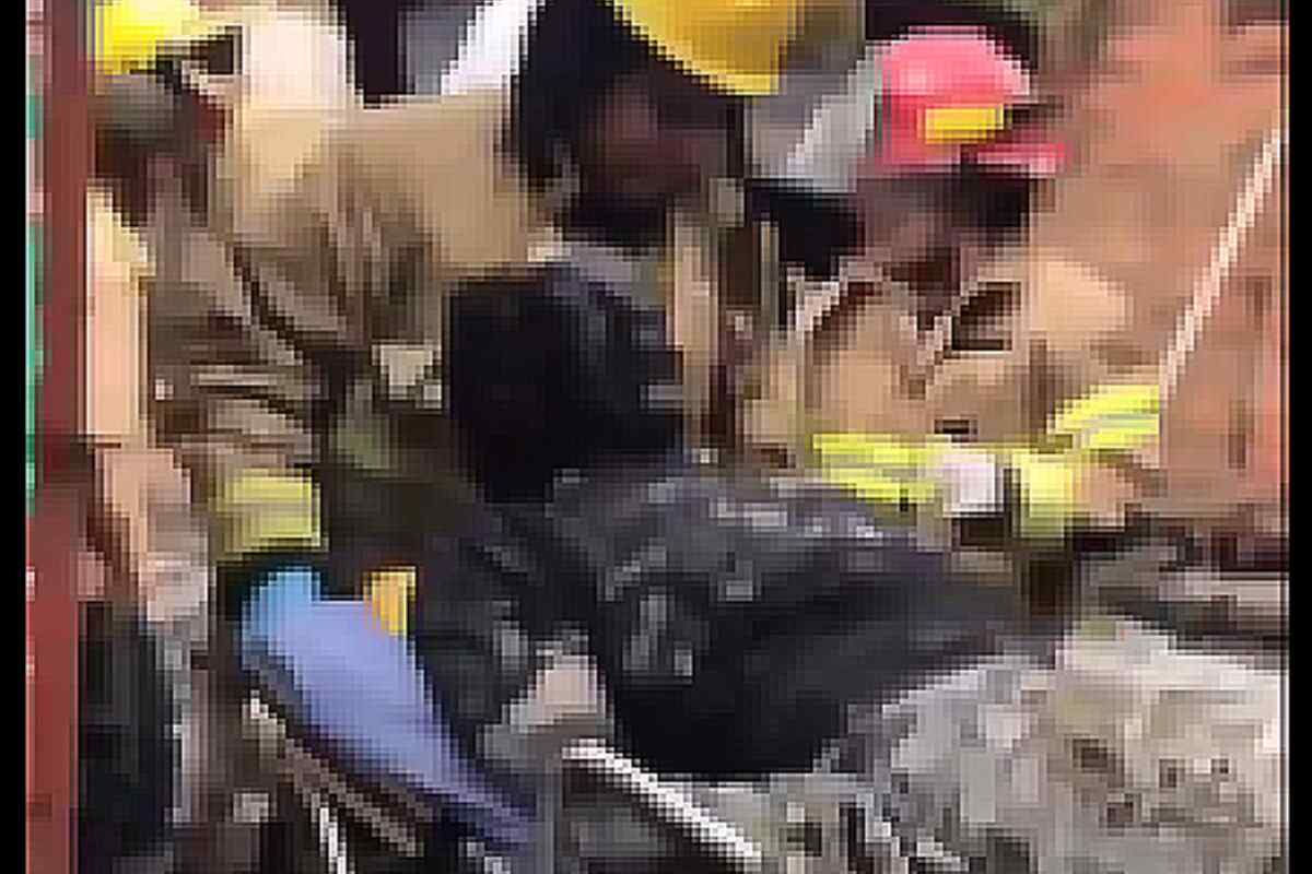 Un hombre sufre graves quemaduras y pierde una pierna por la explosión de una pipeta de gas en Itagüí