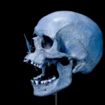 El ADN antiguo explica el origen de la predisposición a enfermedades como la esclerosis