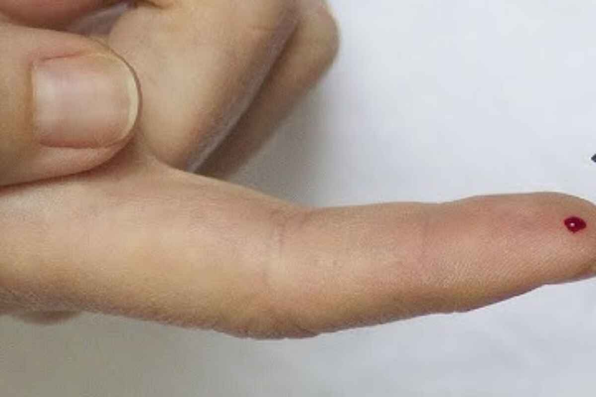 azúcar en la sangre- Hiperglucemia: qué es, cómo detectarla y cómo tratarla. 9 signos que no debes ignorar