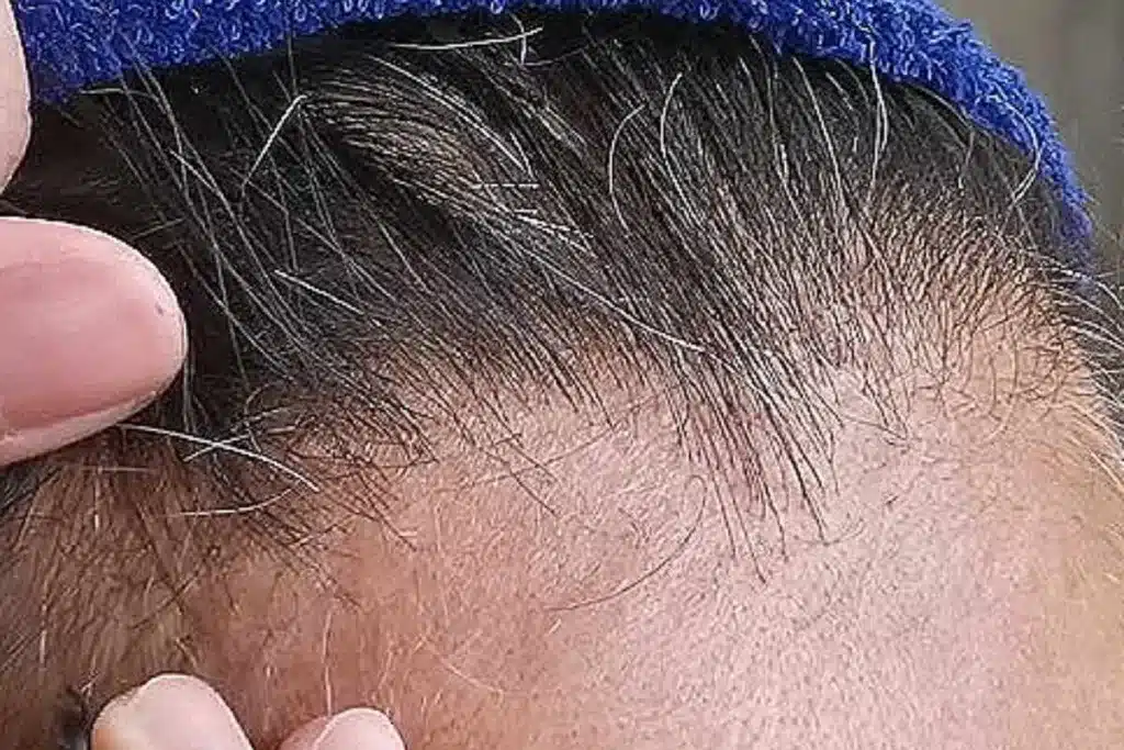 ¿Quieres evitar las canas? Estos son los hábitos que debes cambiar