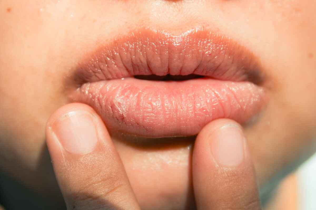 Descubre las Causas Ocultas de los Labios Resecos y Cómo Solucionarlos Eficazmente