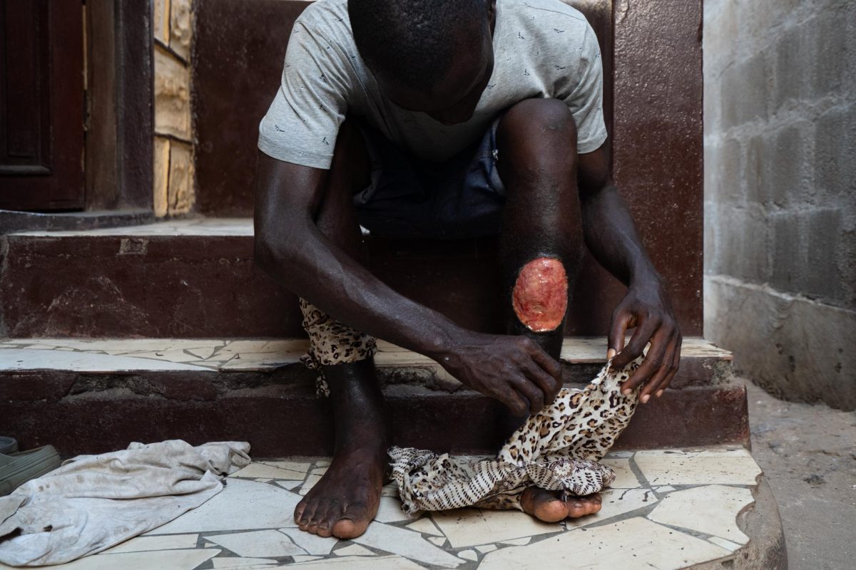 El 'kush', la nueva droga que devasta a los jóvenes de Sierra Leona