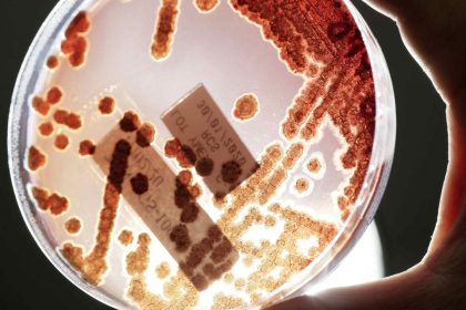 La OMS aprueba resolución para movilizar al mundo ante la resistencia a los antibióticos