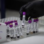 Un estudio abre la puerta a generar células madre en laboratorio para tratar la leucemia