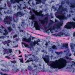 Crean un biomaterial capaz de regenerar cartílago dañado en las articulaciones