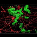 Generan neuronas a partir de células de la piel para estudiar el alzhéimer