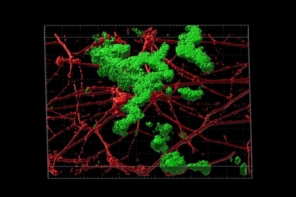 Generan neuronas a partir de células de la piel para estudiar el alzhéimer
