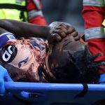 Duván Zapata sufre una lesión de rodilla y abandona San Siro en camilla y entre lágrimas