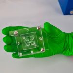 Anticuerpos humanos podrían prevenir infecciones de malaria severa