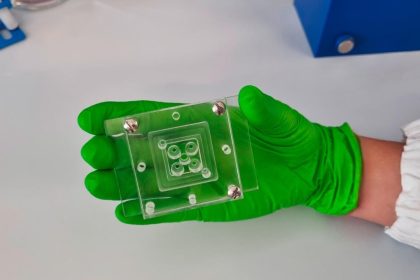 Anticuerpos humanos podrían prevenir infecciones de malaria severa